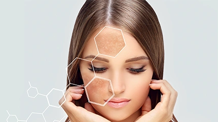 Pigmentation