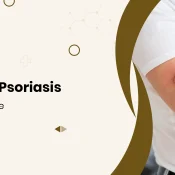 7 Early Signs of Psoriasis