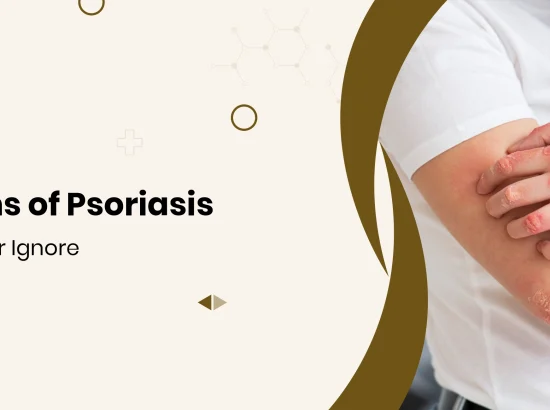 7 Early Signs of Psoriasis You Should Never Ignore