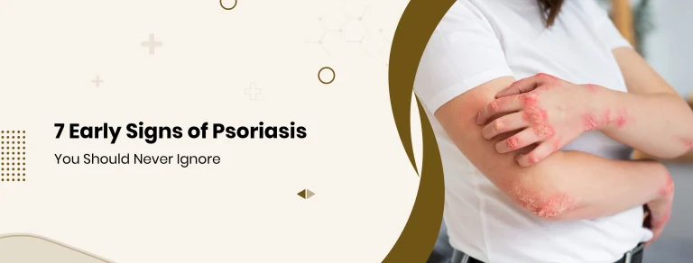 7 Early Signs of Psoriasis